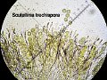 Scutellinia trechispora-amf103-micro
